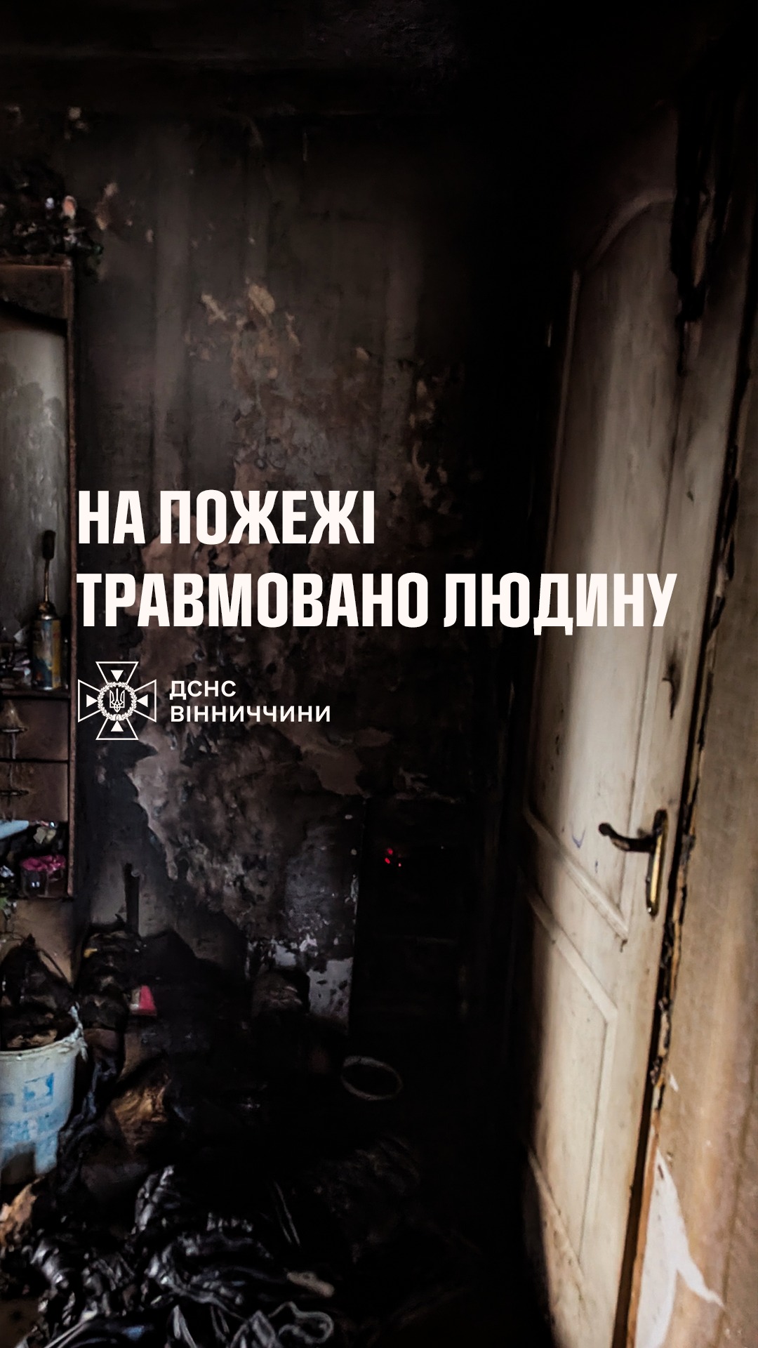 На Вінниччині внаслідок пожежі травмувався 35-річний чоловік