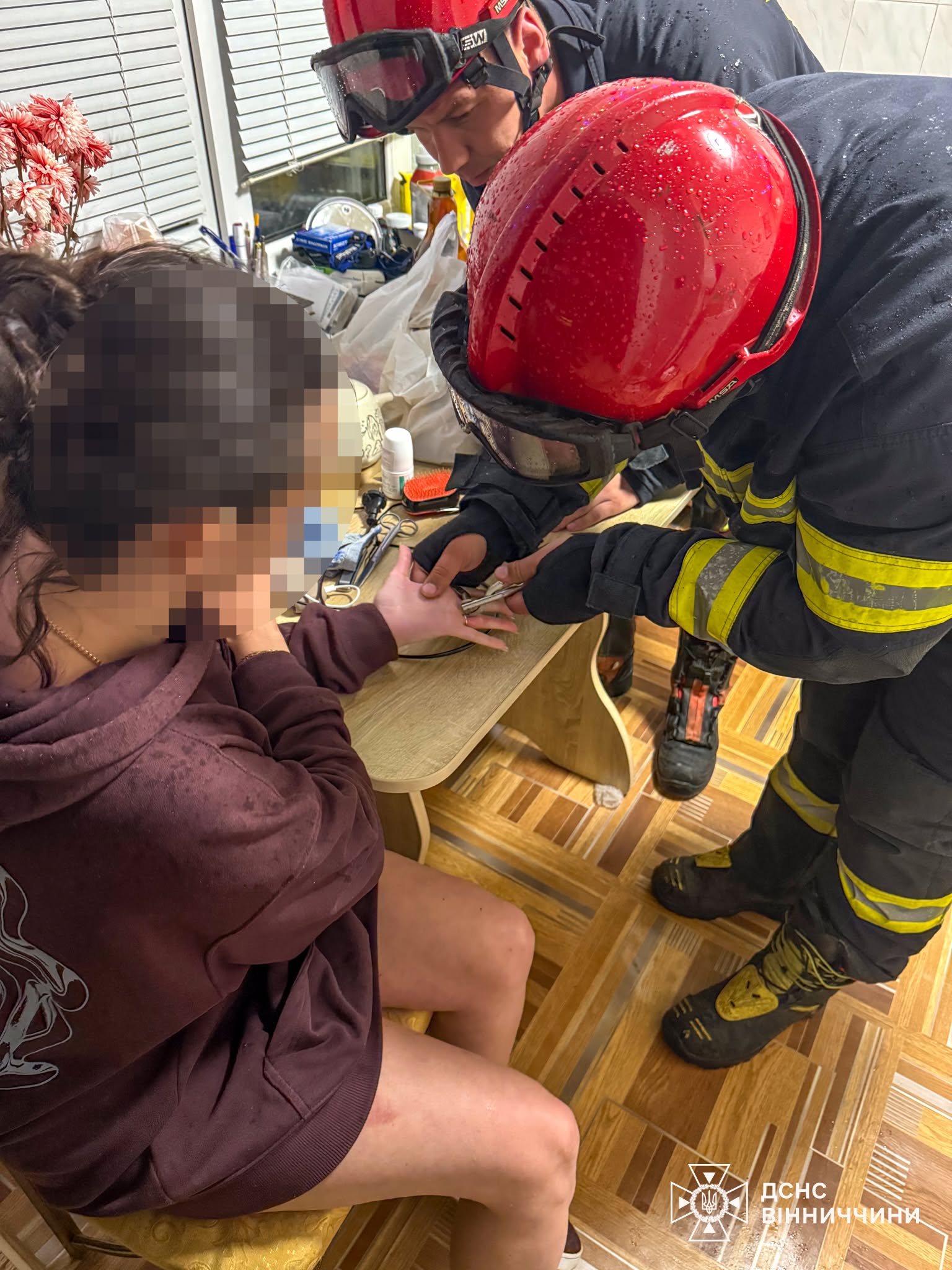 Рятувальники допомогли вінничанці, яка через набряк не могла зняти каблучку з пальця