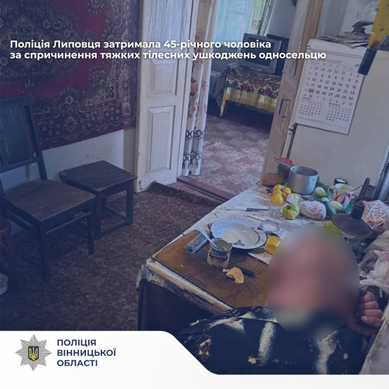 На Вінниччині затримали чоловіка, який побив односельця